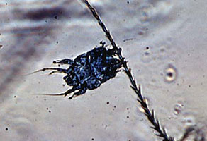 Adult female tracheal mite suspended from honey bee hair. (400X) Courtesy of Tom Webster.