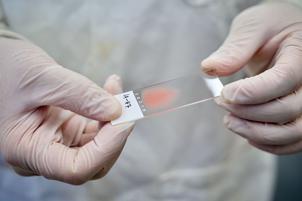 a person holding a microscope slide