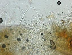 Photo of mycelium Aureobasidium microstichum