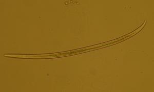 Photo of magnified view of a female foliar nematode
