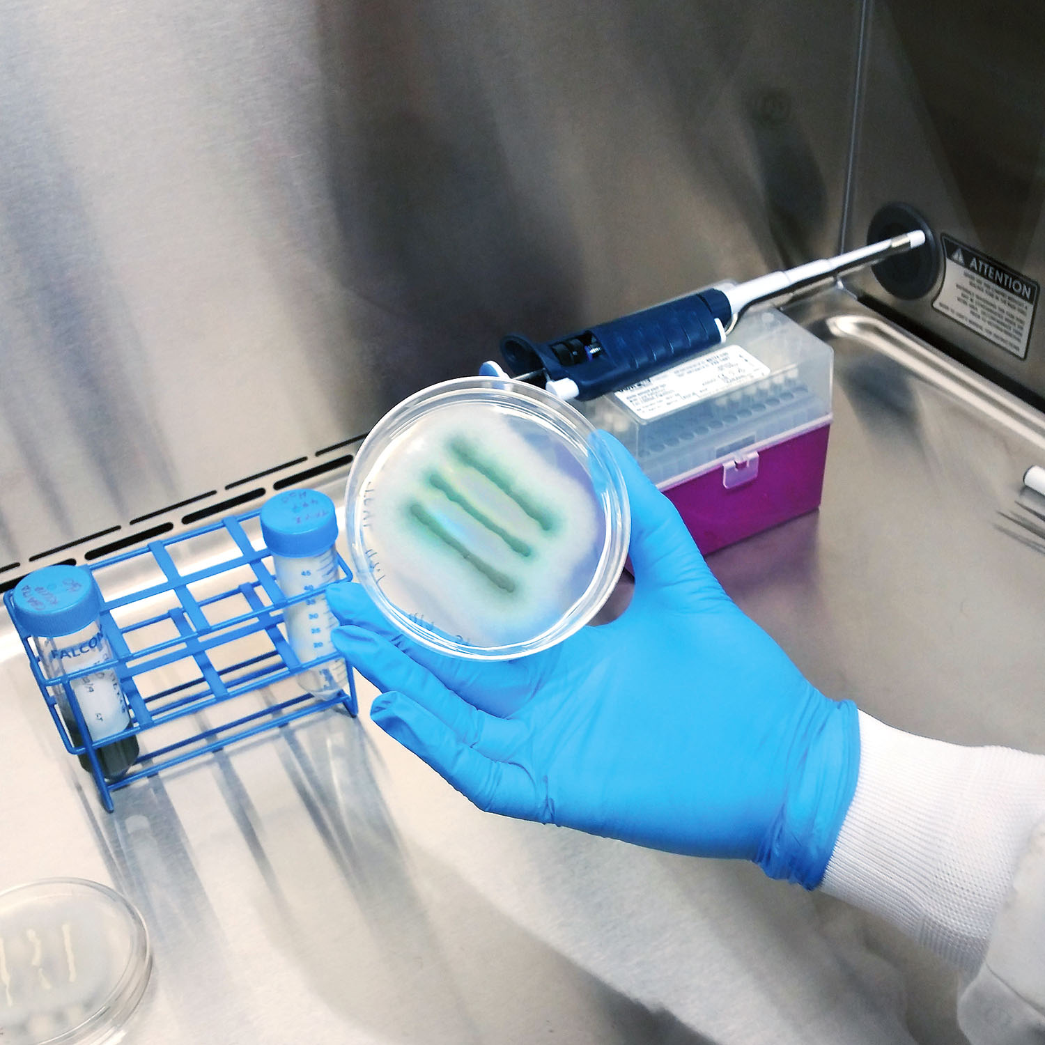 Hand holding petri dish with green fungus.